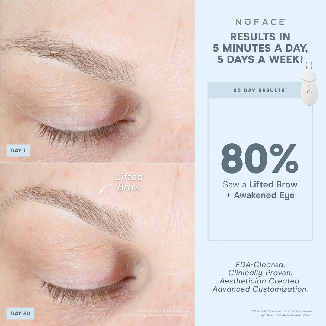NuFACE Eye & Lip Enhancer