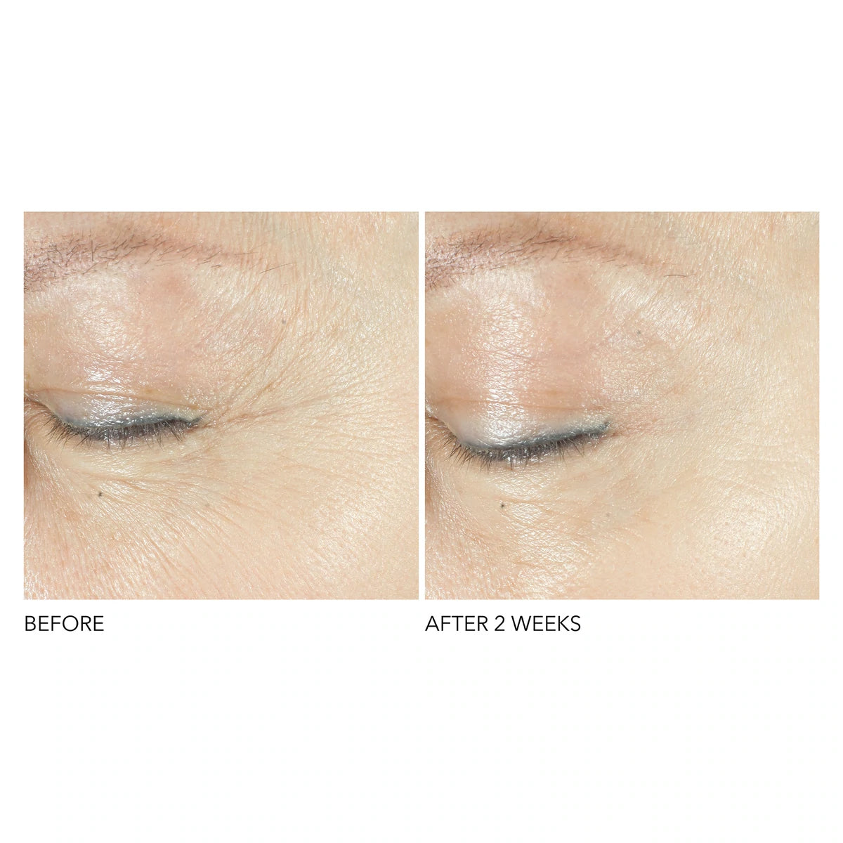 Triple Correction Eye Serum