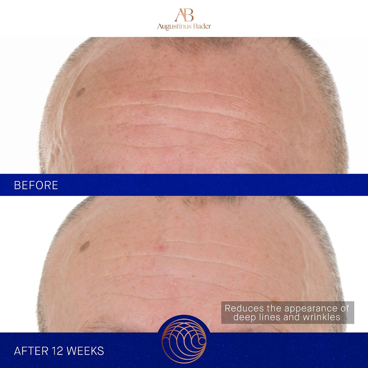 The Retinol Serum