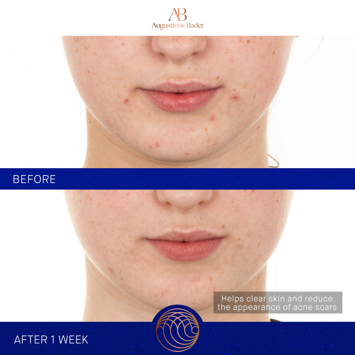 The Retinol Serum