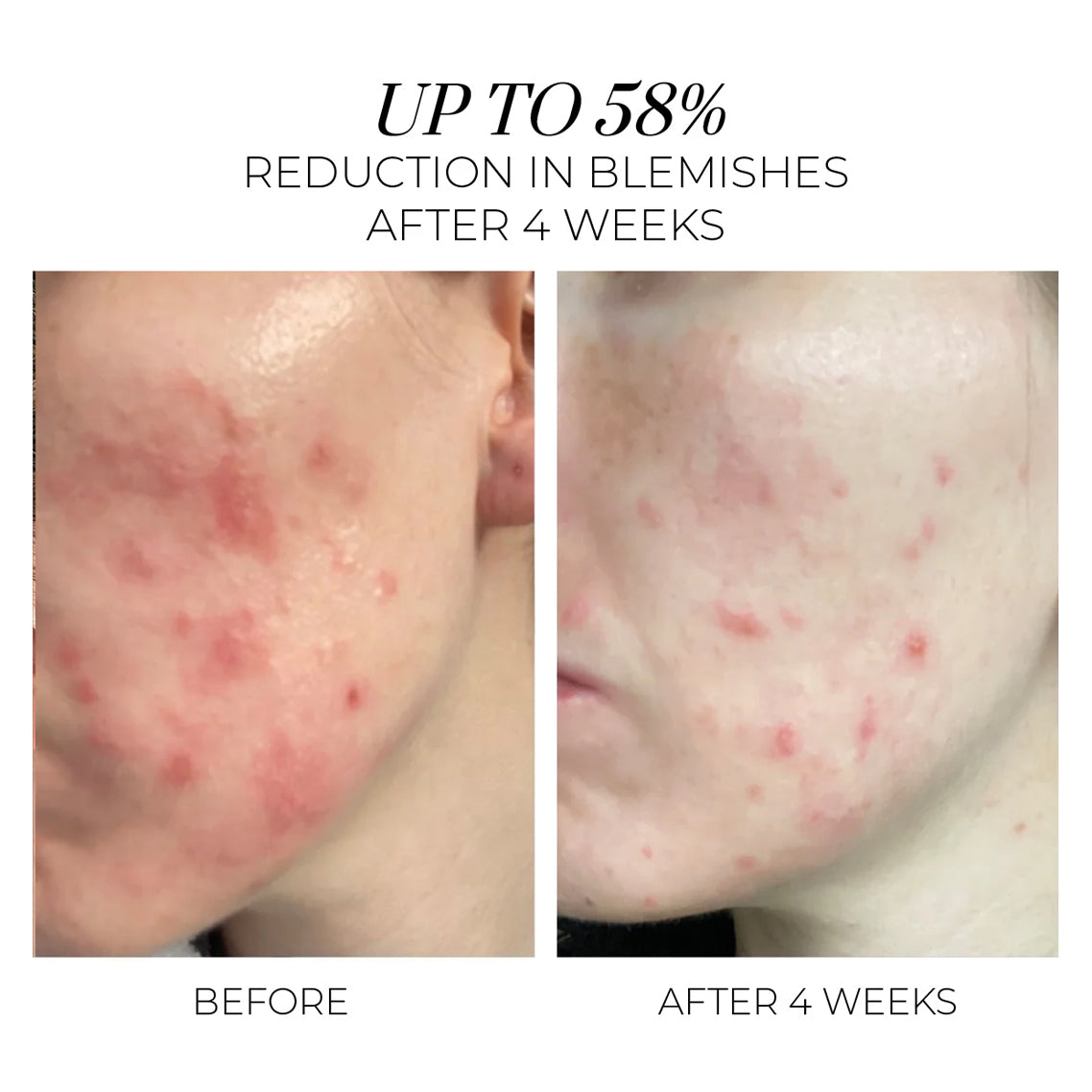 Violet Water Treatment Tonic