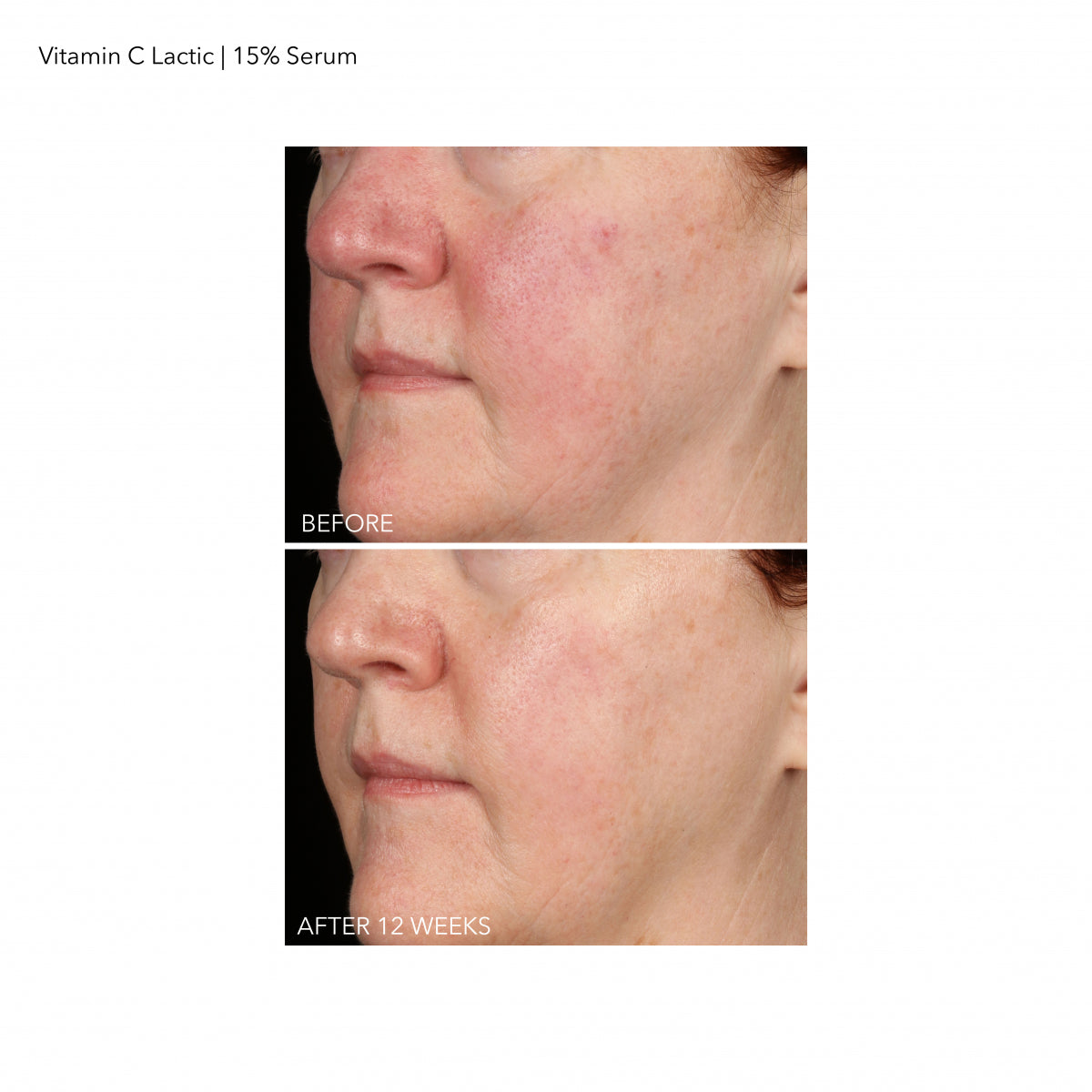 Vitamin C + Lactic 15% Vitamin C Firm & Bright Serum