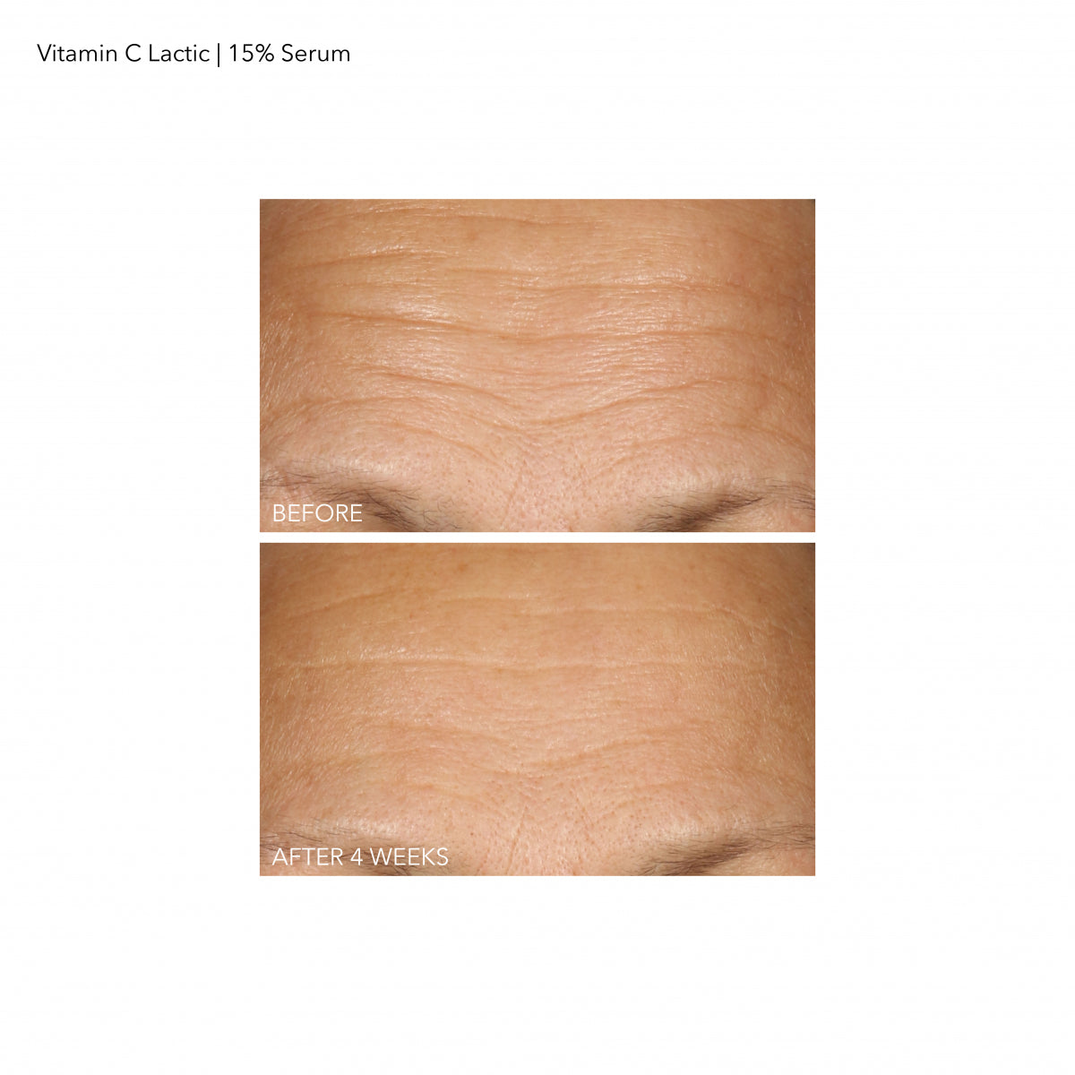 Vitamin C + Lactic 15% Vitamin C Firm & Bright Serum