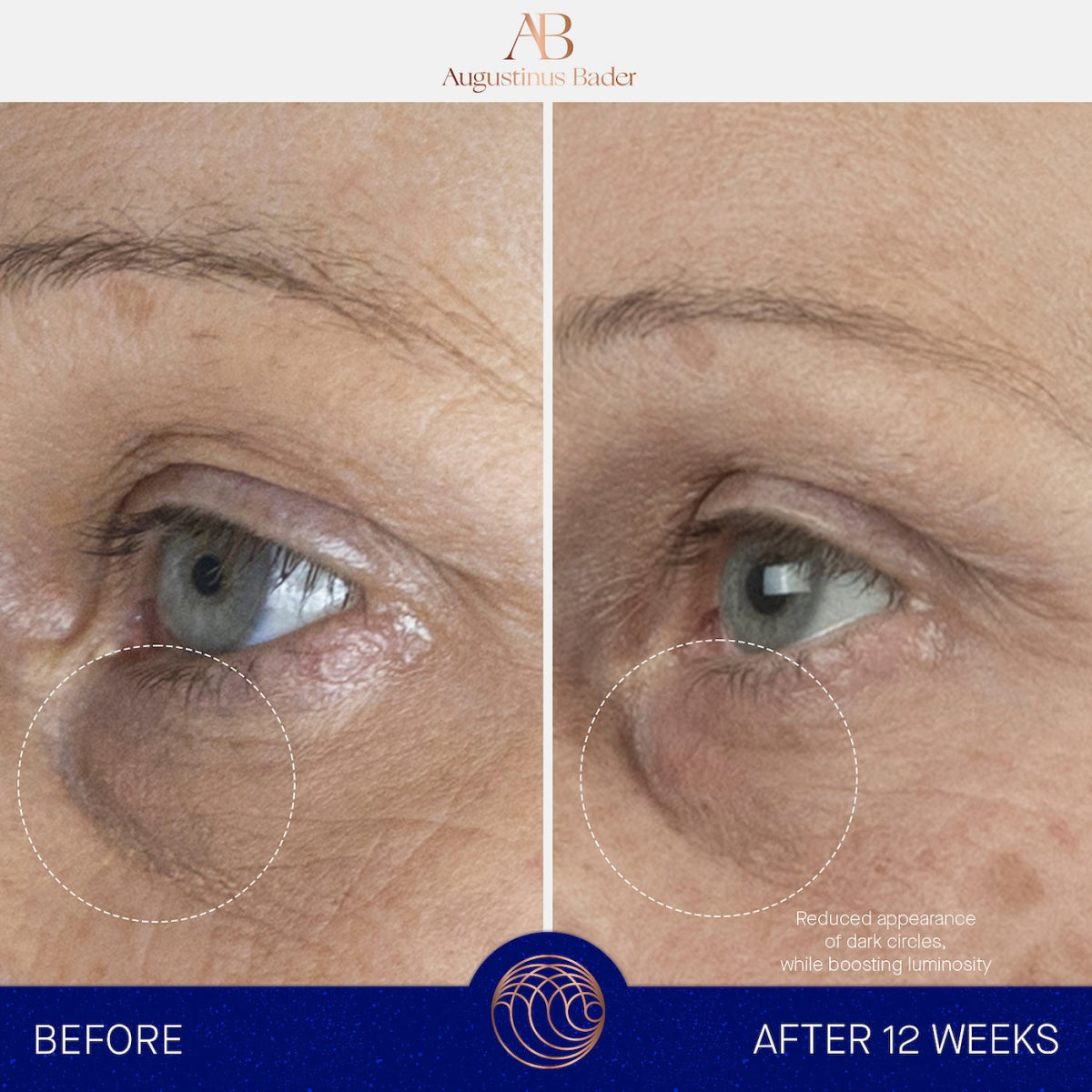 The Eye Cream Nomad Refill